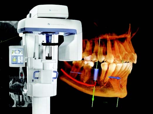 Dental implant candidate consultation
