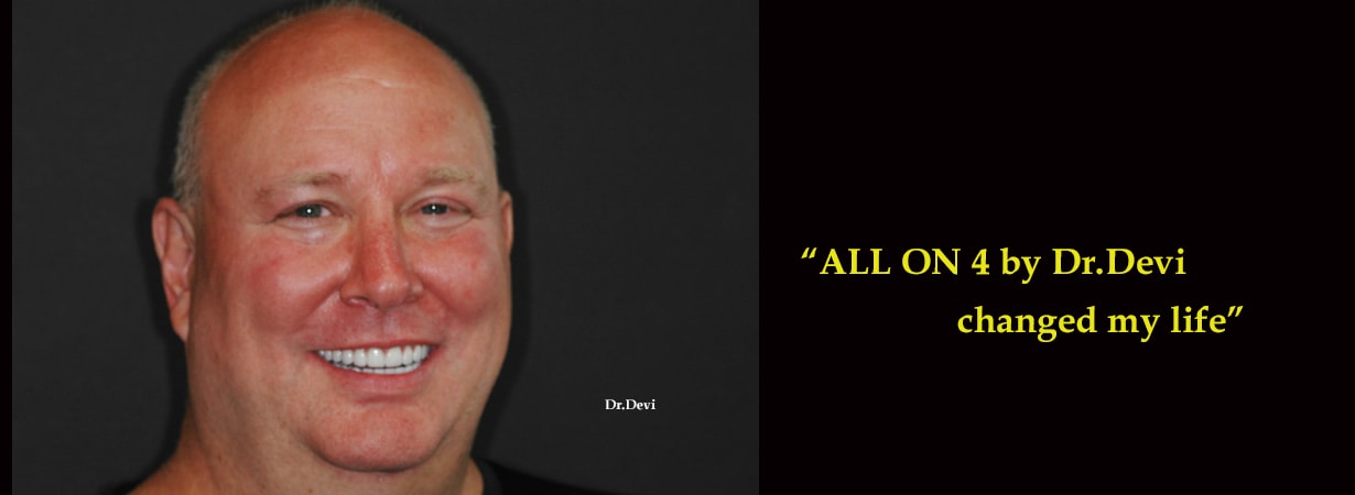Happy patient after All-on-4 dental implants