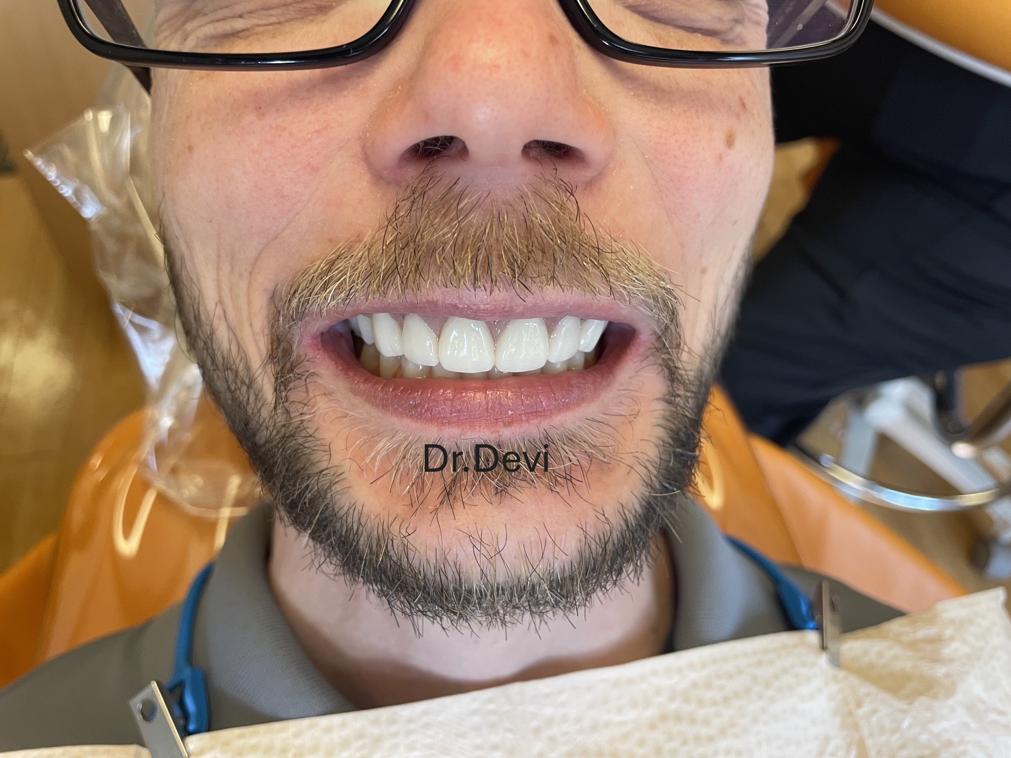 Final Smile